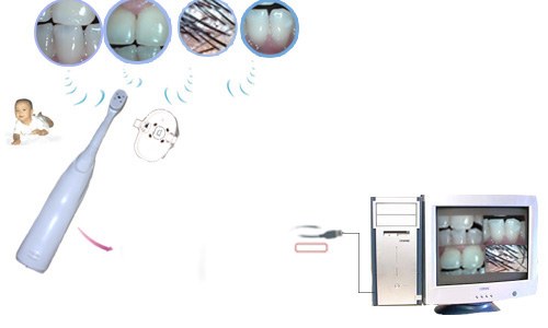 camera oral 2